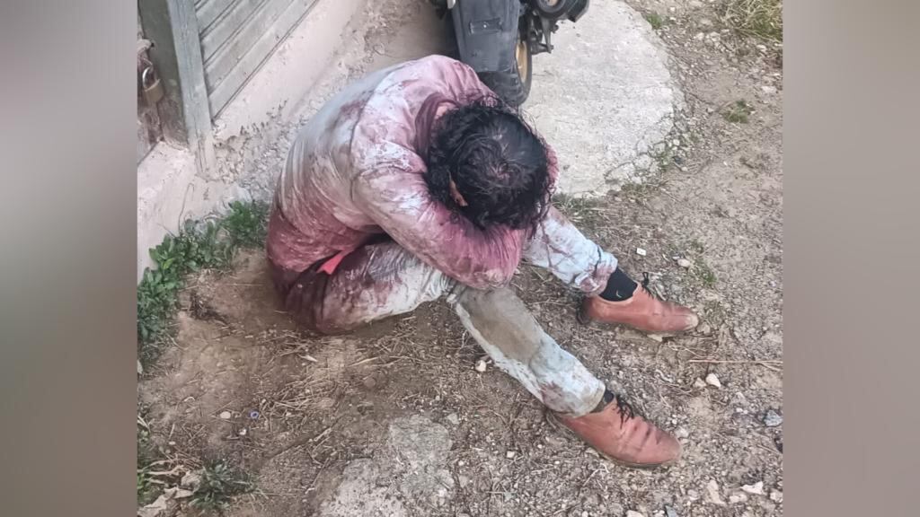 Este ciudadano sueco murió tras la gravedad de las heridas luego de ser víctima del paseo millonario en Medellín.