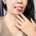 Todo se originó después de que se mordiera la lengua con una muela que tenía infectada.