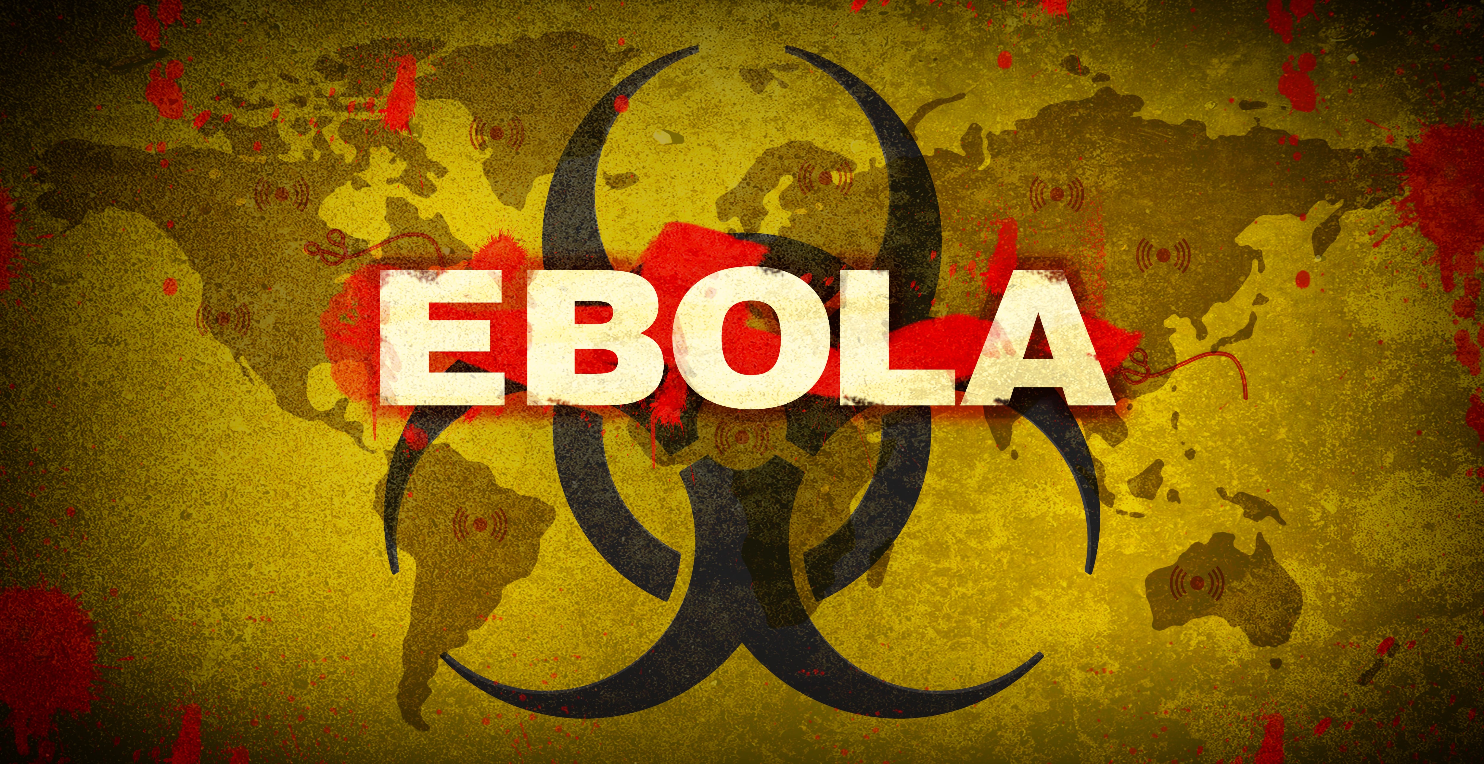 Los síntomas iniciales del Ébola pueden parecerse a los de otras enfermedades comunes, lo que dificulta su diagnóstico temprano.