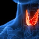 hipotiroidismo, o tiroides hipoactiva