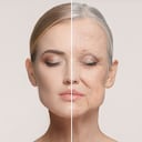 Las arrugas son parte del envejecimiento natural de la piel.