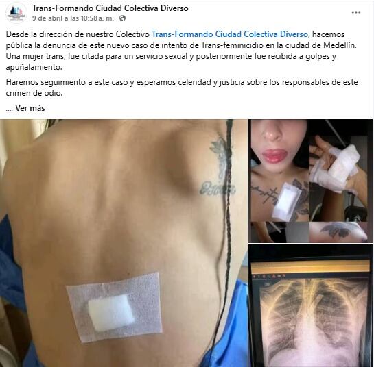 La denuncia fue hecha por el Colectivo Diverso Trans-Formando Ciudad.