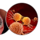 Cualquier úlcera de color blanco o roja en lengua, labios, carrillos, deben estudiarse.