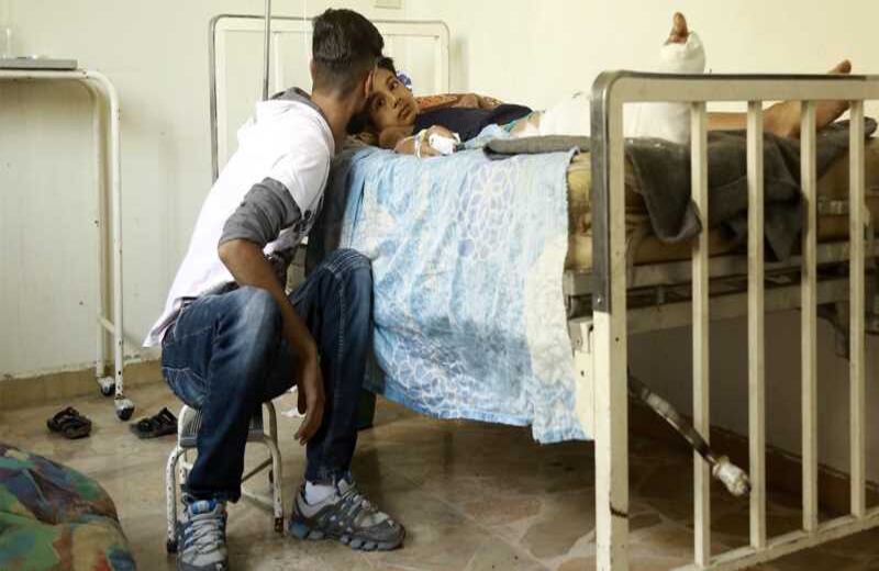 Un niño herido de Siria en una cama de hospital, un día después de que se le habría herido en un ataque aéreo de las fuerzas del gobierno sirio. 20 de agosto del 2016. Foto: AFP.