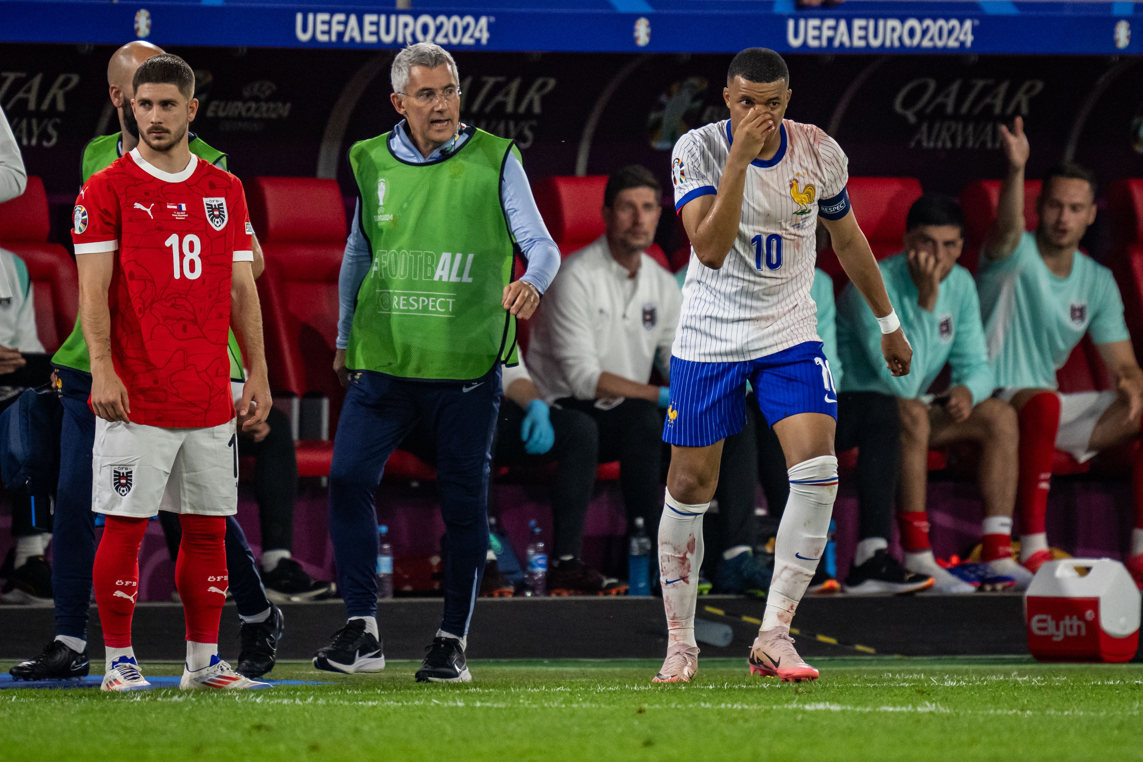 Mbappé se llevó el reproche de todo el estadio.