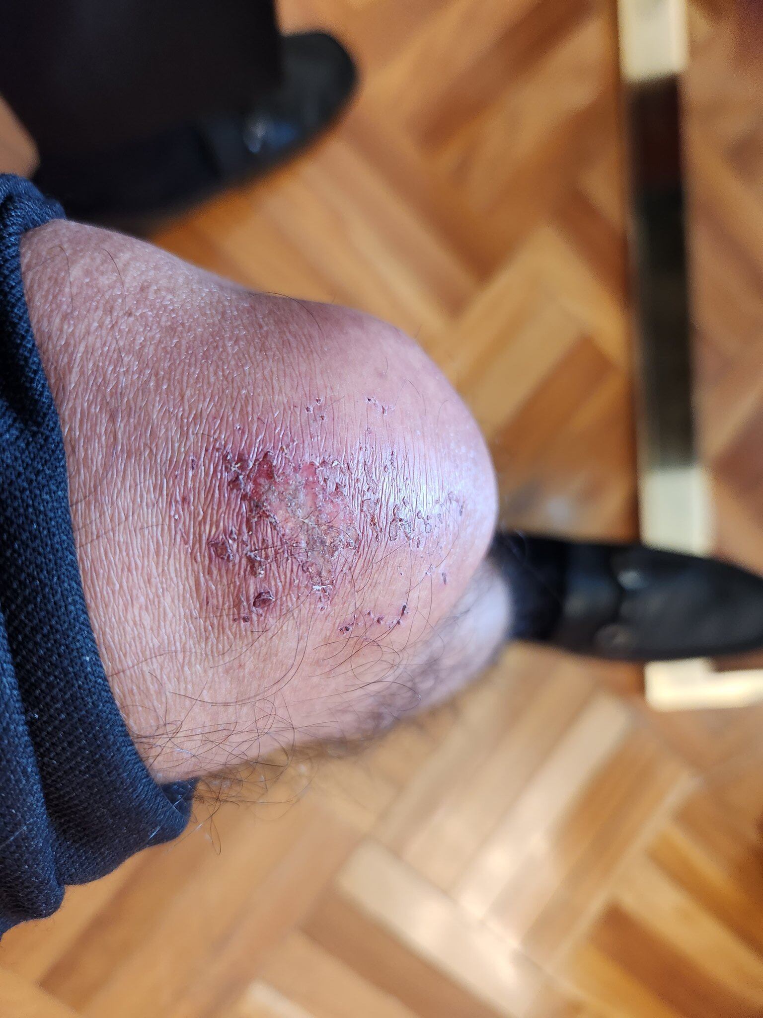 Foto caída presidente Petro