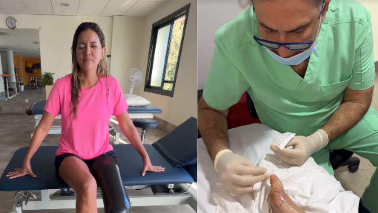 Daniella Álvarez mostróa sus seguidores el nuevo problema de salud que tiene.