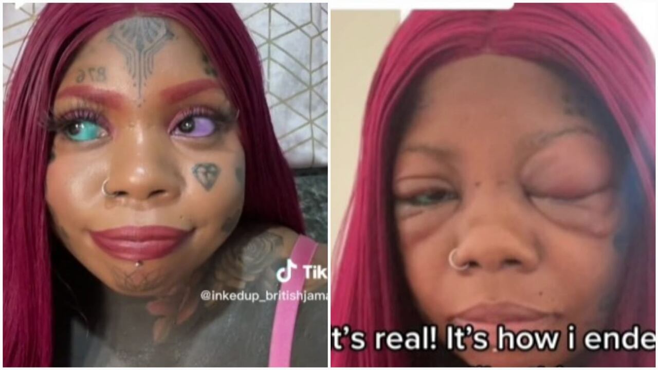 Mujer dice estar arrepentida por tatuarse los ojos.