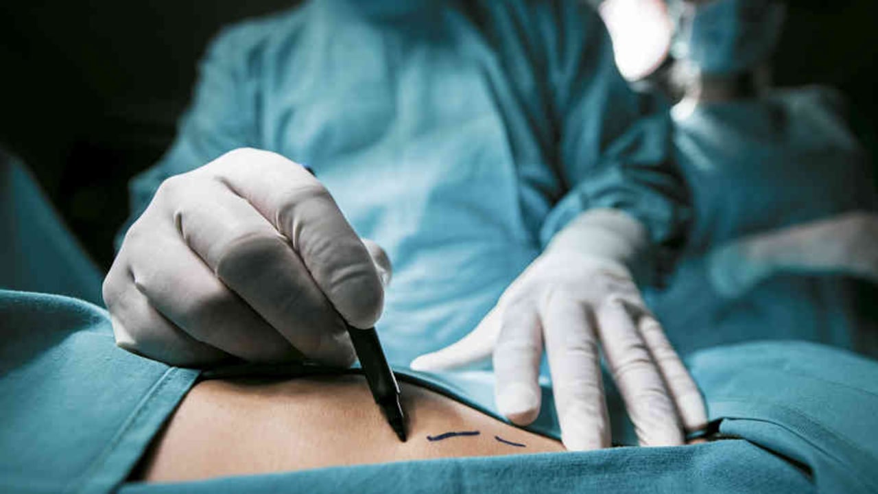 Cirugías estéticas en falsos centros médicos, cobran vidas en Bogotá. foto: A.P.I.