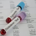 El colesterol y los triglicéridos elevados pueden generar complicaciones en el corazón.