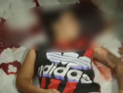 La víctima recibió un disparo en la cabeza.