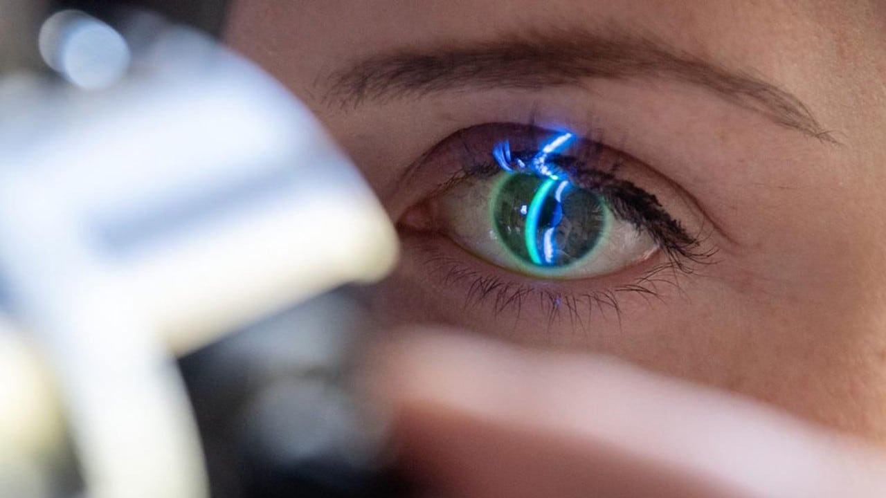 Según los expertos, los daños oculares se pueden identificar a simple vista en algunos casos.