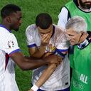 Kylian Mbappé salió con la nariz fracturada del debut con Francia en la Euro 2024