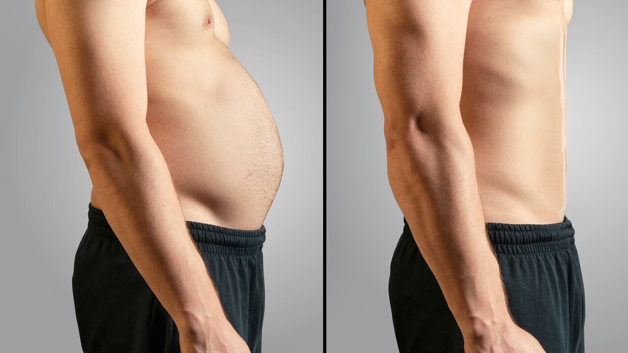 La obesidad es un factor de riesgo de muchas enfermedades.