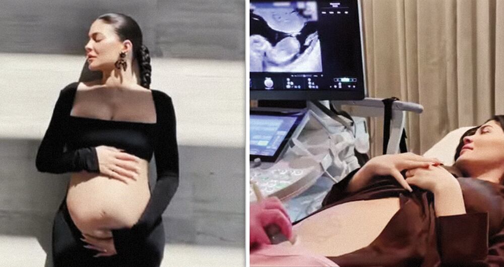 De acuerdo con la revista Forbes, el patrimonio actual de la menor de las Kardashian, asciende a cerca de 620 millones de dólares. 
