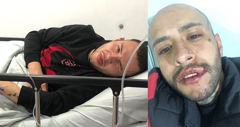 Fractura de costillas, labio seriamente afectado y múltiples moretones es el resultado del ataque a una pareja gay en el sur de Bogotá.