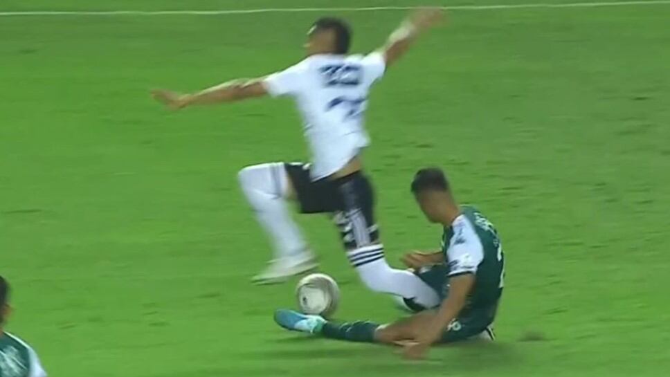 Lesión que sufrió Luis Paredes en el 'Clásico Añejo', entre Deportivo Cali y Millonarios