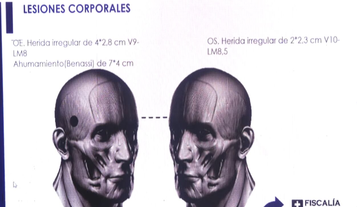 Imagen expuesta por la Fiscalía General de la Nación sobre la trayectoria del disparo que acabó con la vida del coronel Dávila.