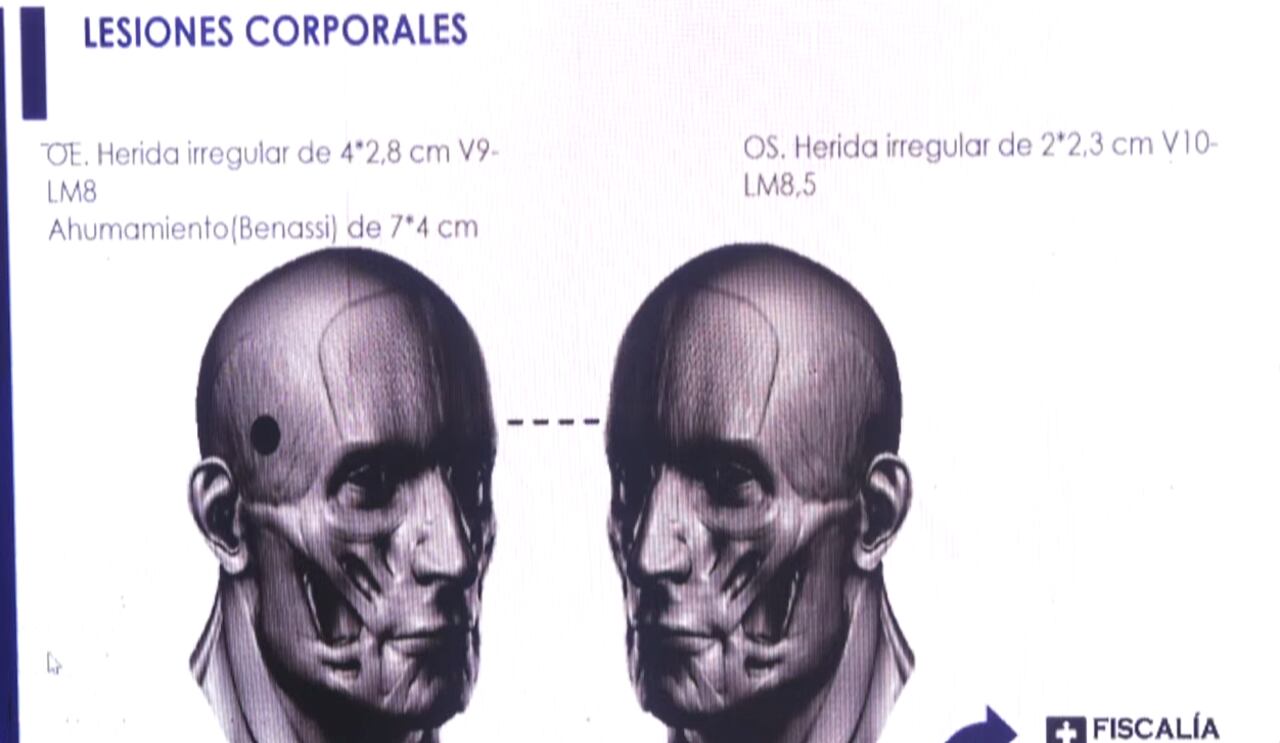 Imagen expuesta por la Fiscalía General de la Nación sobre la trayectoria del disparo que acabó con la vida del coronel Dávila.