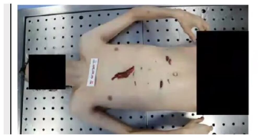 Cuerpo sin vida de Mauricio Leal