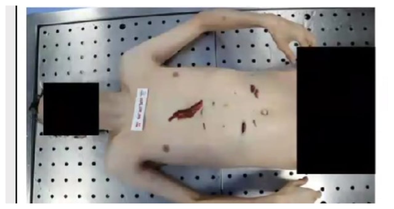 Cuerpo sin vida de Mauricio Leal