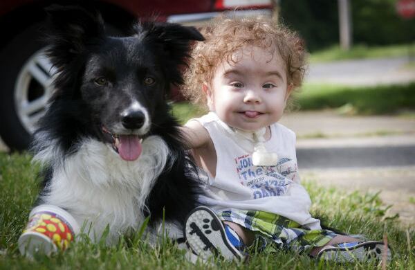 Kaiba juega con su perro en Ohio, EE.UU. Este niño tiene el primer conducto aéreo biodegradable del mundo, que le ayuda a afrontar su enfermedad respiratoria. (AP)
