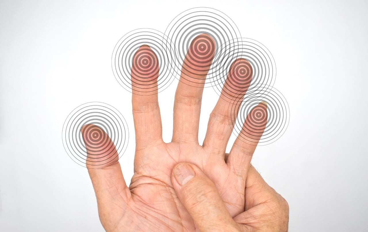 Adormecimiento en las manos