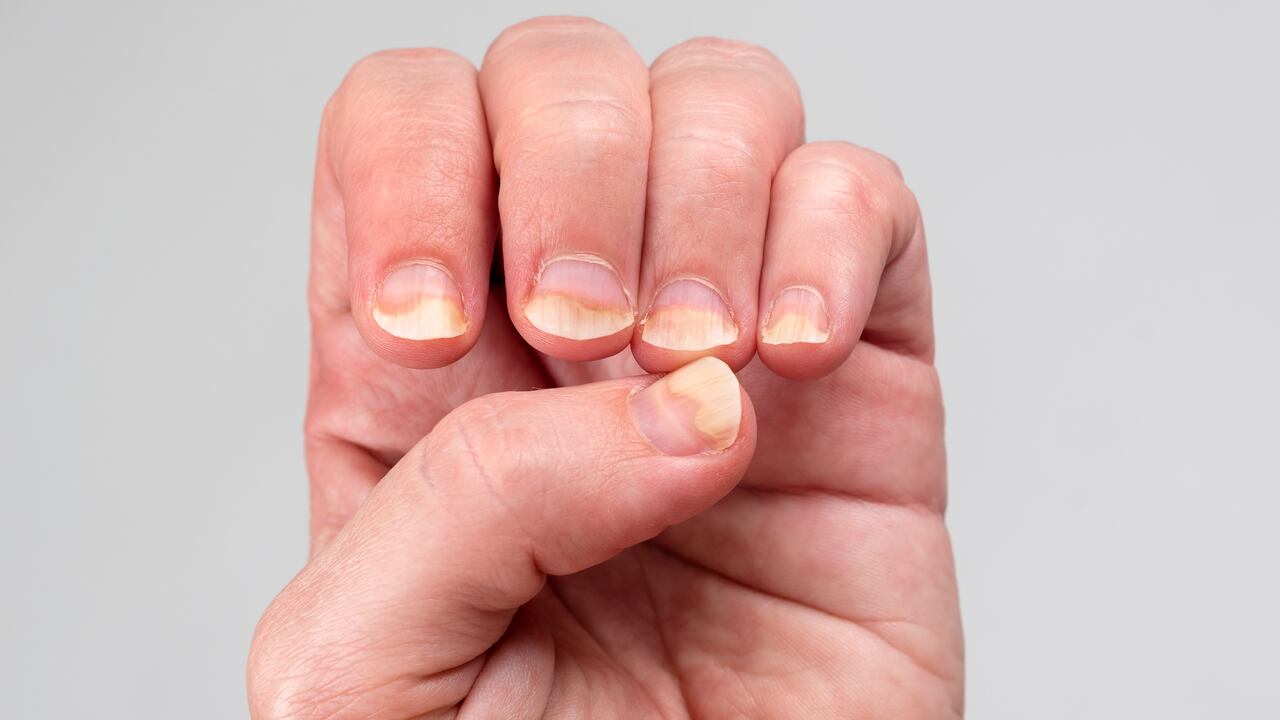 Aunque se puede asociar con un "trauma local", es importante siempre consultar con un profesional de la salud.