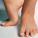 Para el que corre con el pie calzado, "es como sufrir un golpe de martillo en el talón", dijo Lieberman. En cambio, "los corredores descalzos prácticamente no sufren colisíón".