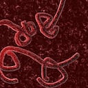 Virus del ébola.