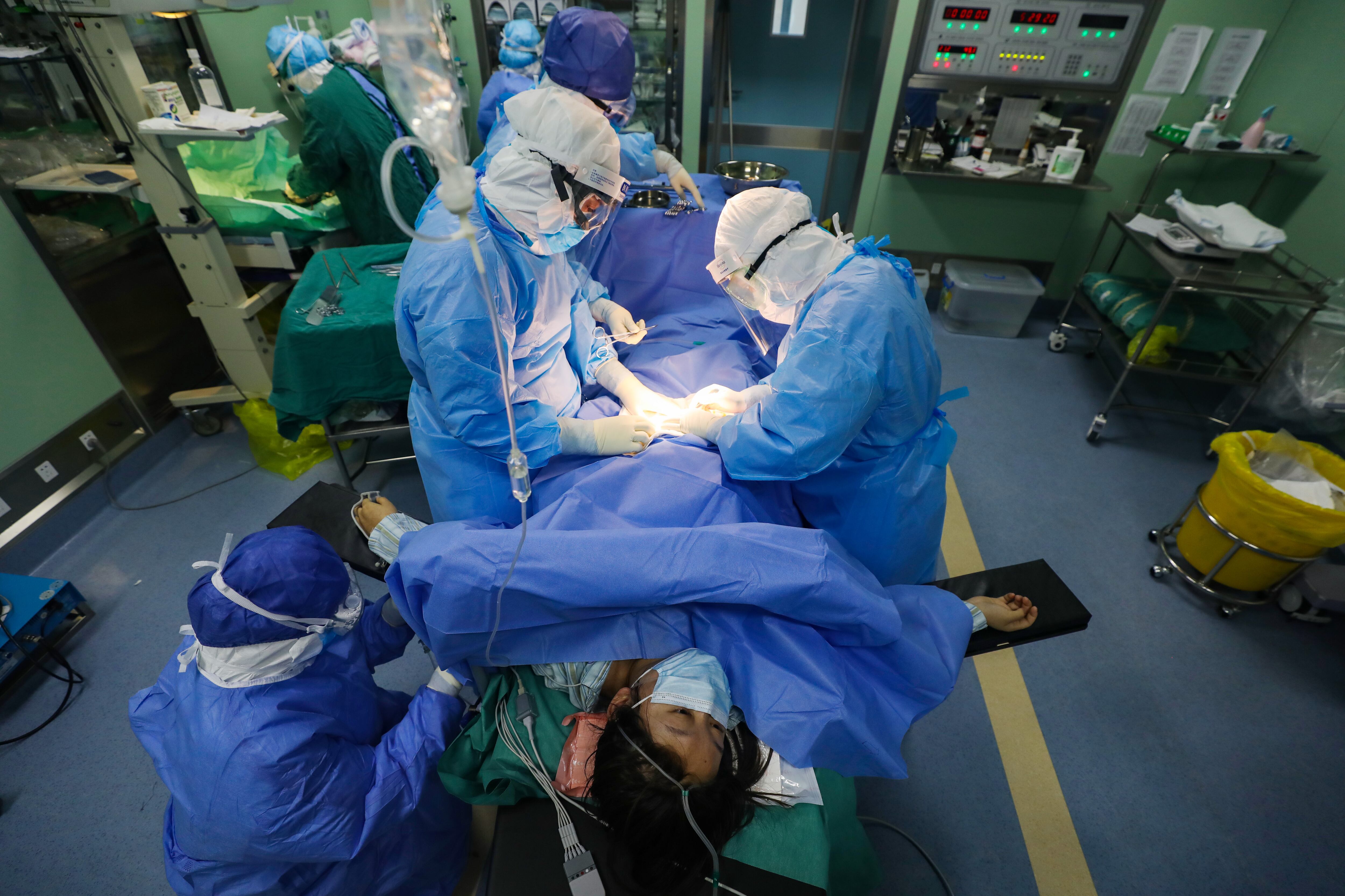 Trabajadores médicos realizan la operación de cesárea en una paciente sospechosa de COVID-19