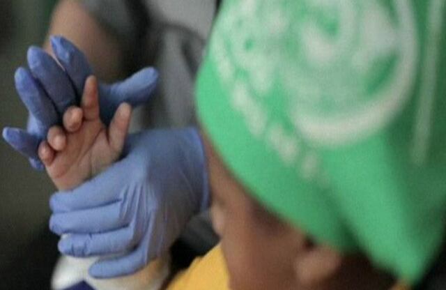 Harvey deberá pasar por un largo período de rehabilitación y tendrá que tomar medicamentos toda su vida para evitar un rechazo. 