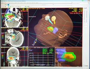 Centro de Terapia de Protones Rinecker en Munich, Alemania. La terapia de protones implica irradiar células cancerosas concentrando un haz de protones en el corazón del tumor, preservando al mismo tiempo el tejido sano circundante (Foto de: BSIP/Universal Images Group vía Getty Images)