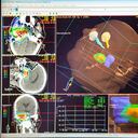 Centro de Terapia de Protones Rinecker en Munich, Alemania. La terapia de protones implica irradiar células cancerosas concentrando un haz de protones en el corazón del tumor, preservando al mismo tiempo el tejido sano circundante (Foto de: BSIP/Universal Images Group vía Getty Images)