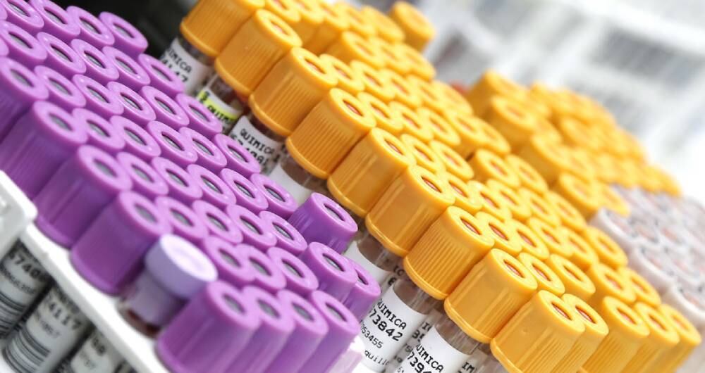 Para conocer los niveles de insulina solo se necesita un sencillo examen de sangre, por lo que se recomienda solicitarlo al médico en una cita de control. 