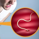 Los parásitos intestinales pueden ser muy riesgosos para las personas con sistemas inmunes debilitados.