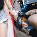 Los tatuajes pueden ser eliminados.