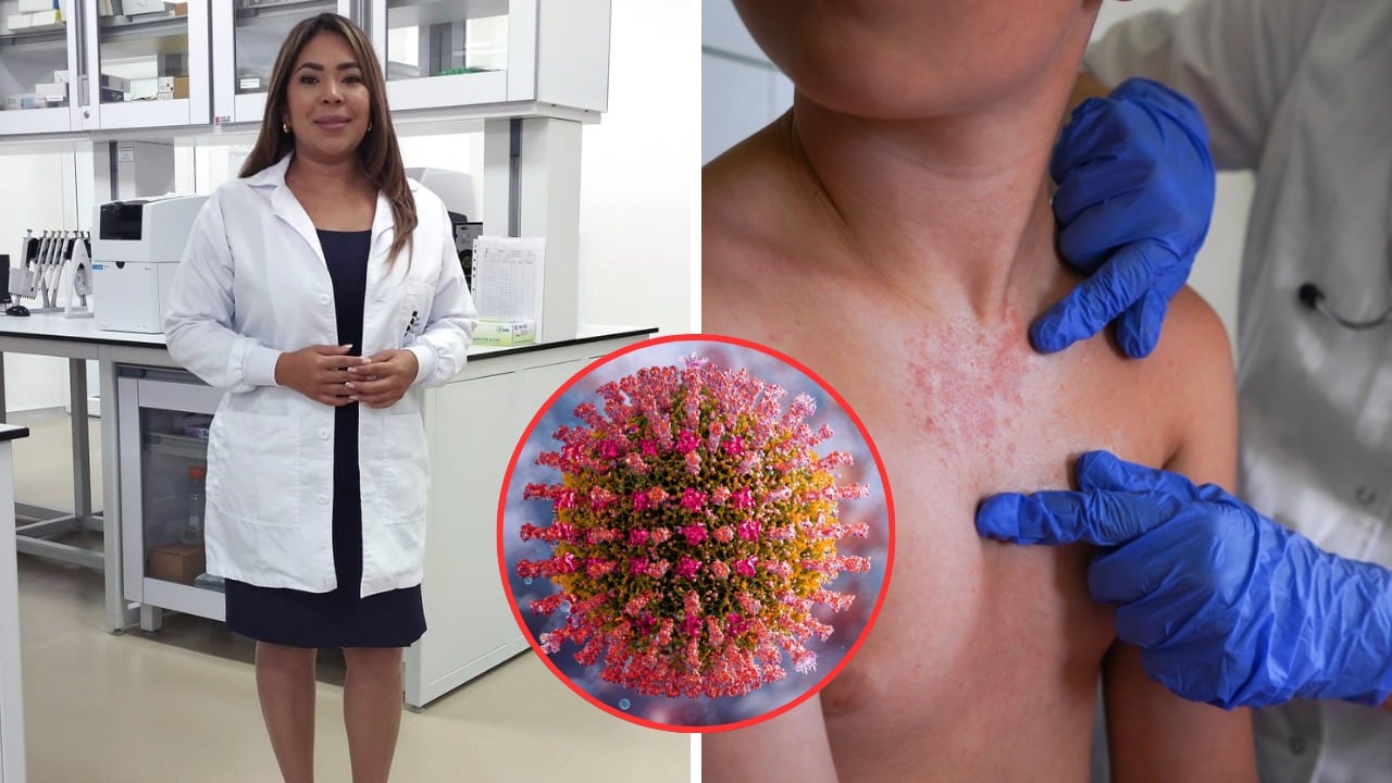 Detrás de cada caso sospechoso existe una compleja red de análisis epidemiológico y pruebas de laboratorio.