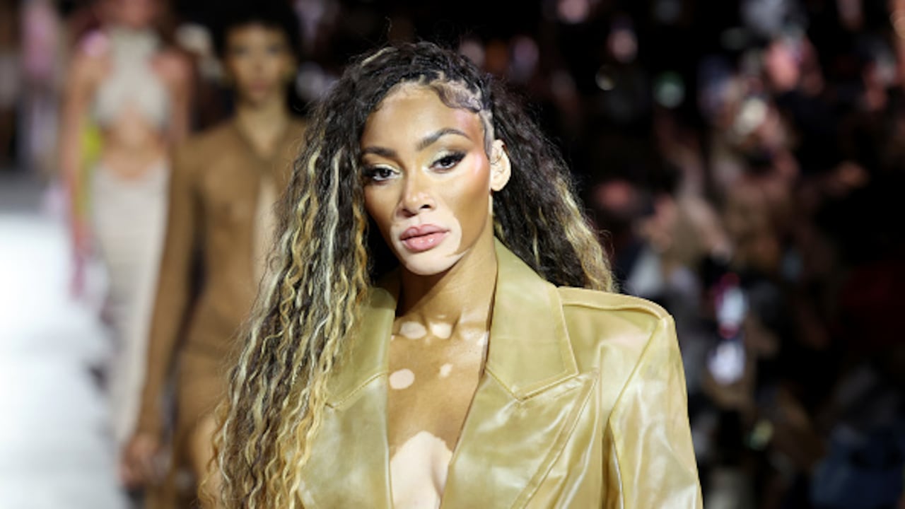 Winnie Harlow nació en Canadá. (Photo by Arturo Holmes/Getty Images)