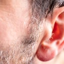 Es importante tener cuidado de no cortar las orejas al realizar estos métodos.