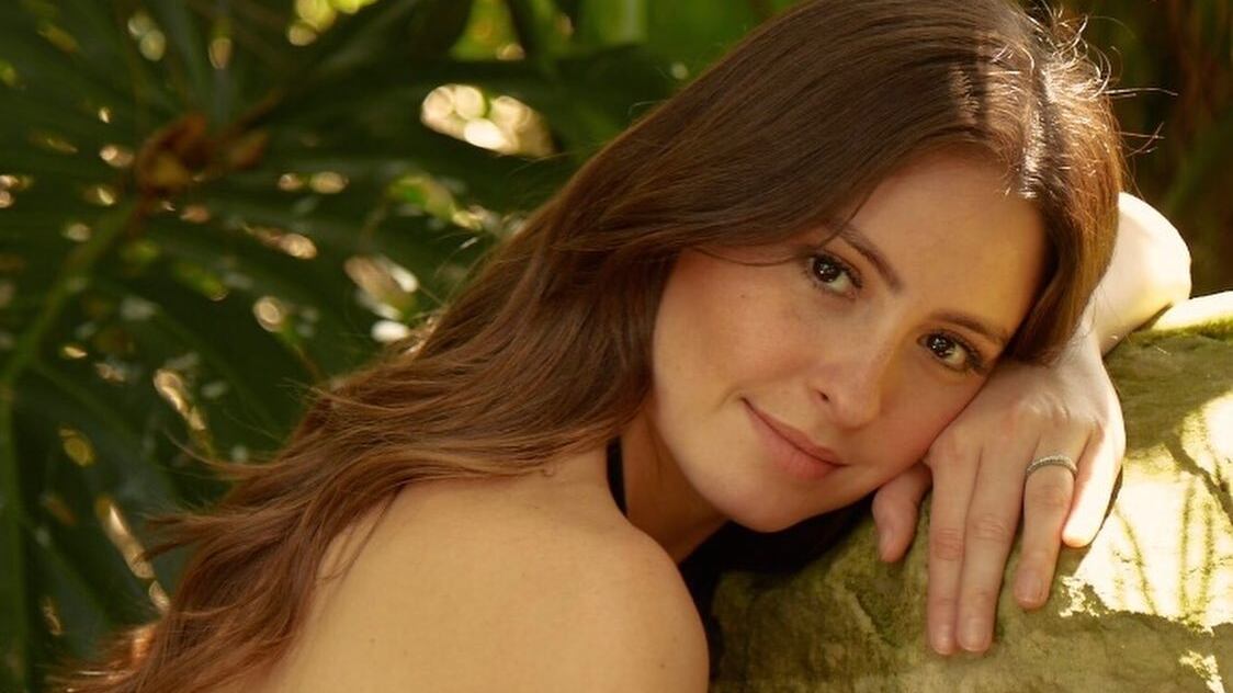 Taliana Vargas reveló que sufre de fuerte enfermedad en su piel