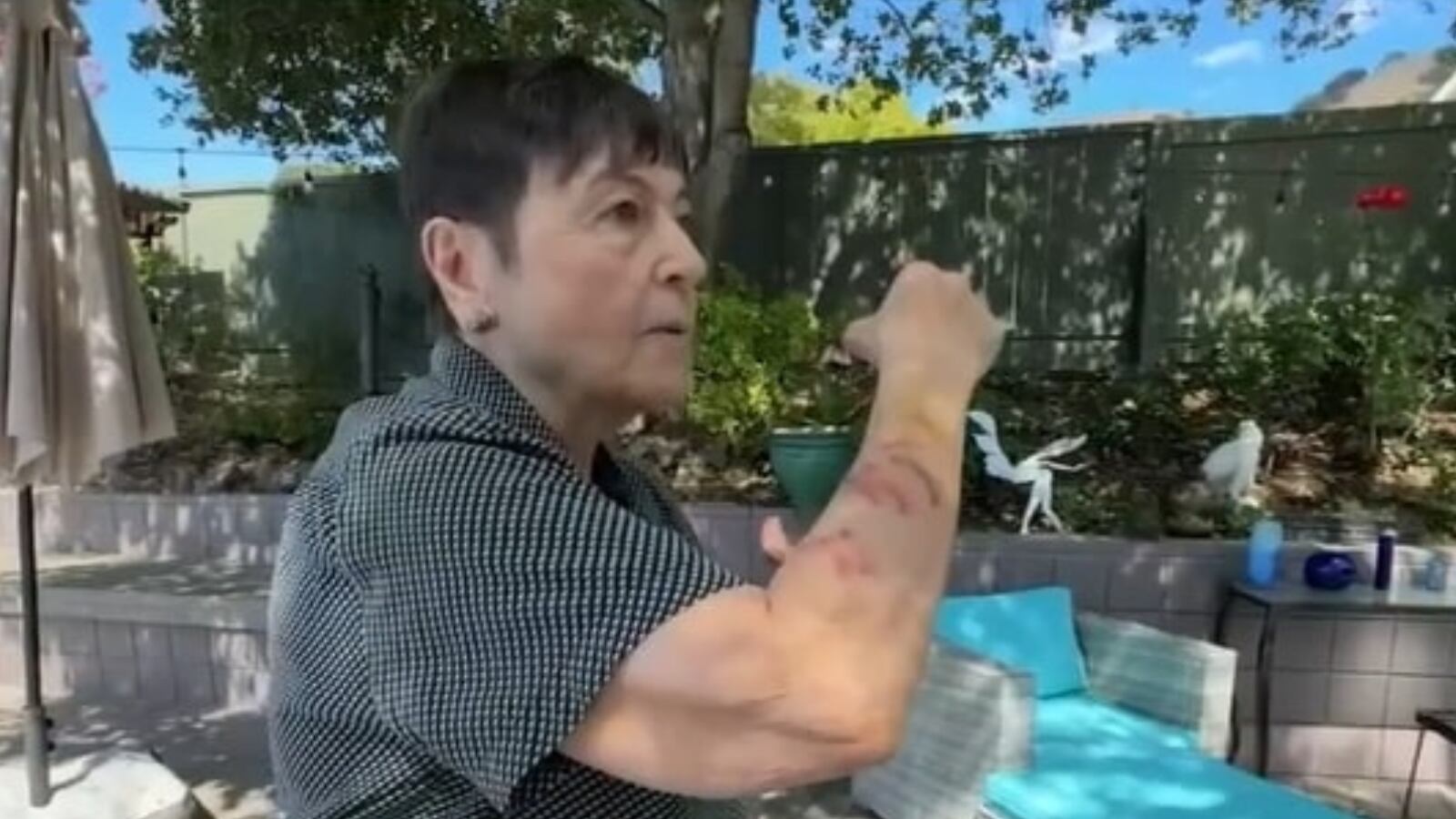 Peligrosa ardilla ataca a los vecinos de un barrio en California