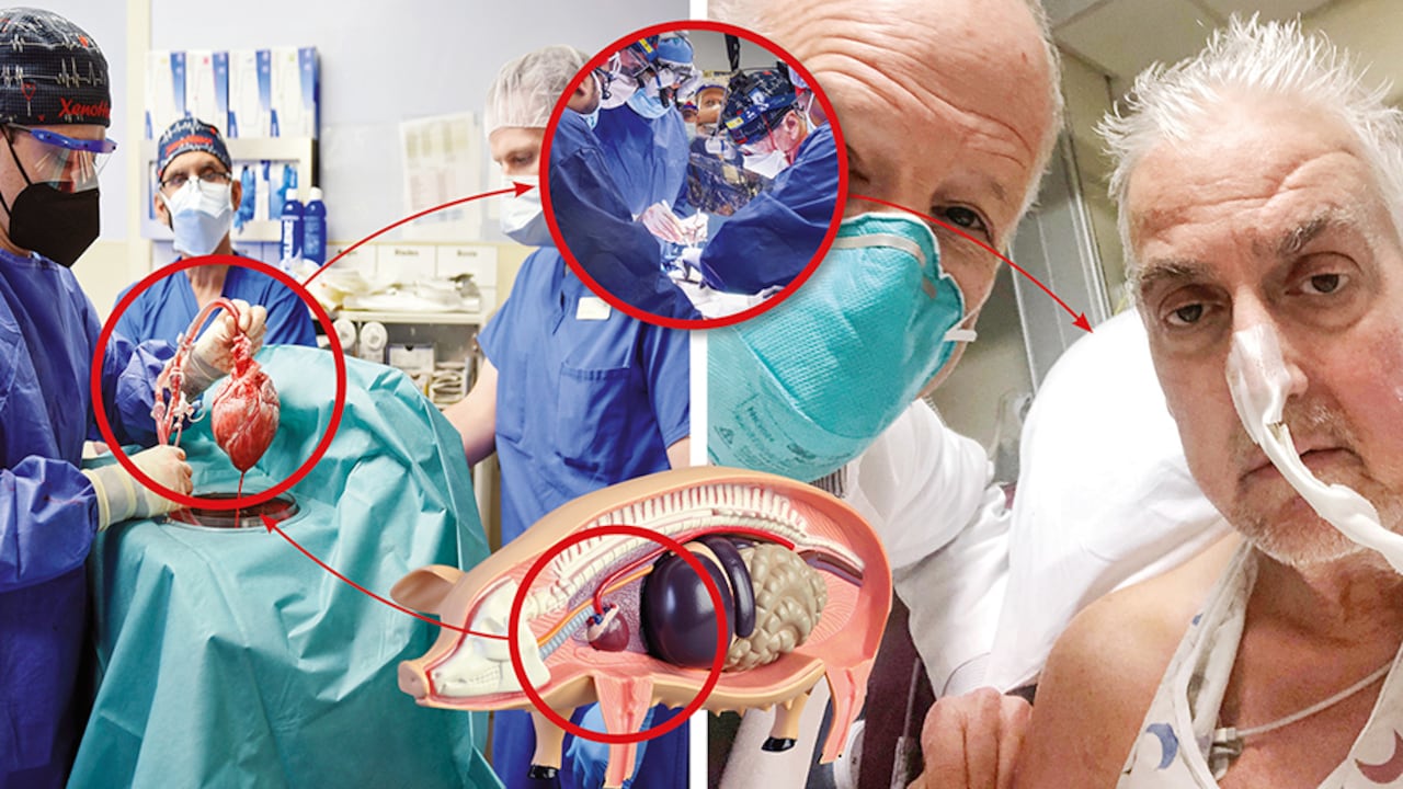 Bennett optó por el tratamiento experimental, pues había agotado otras alternativas y estaba muy enfermo.