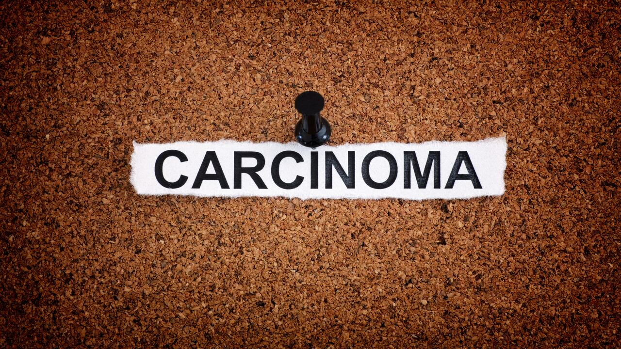 El cáncer es una enfermedad que afecta a millones de personas en el mundo.