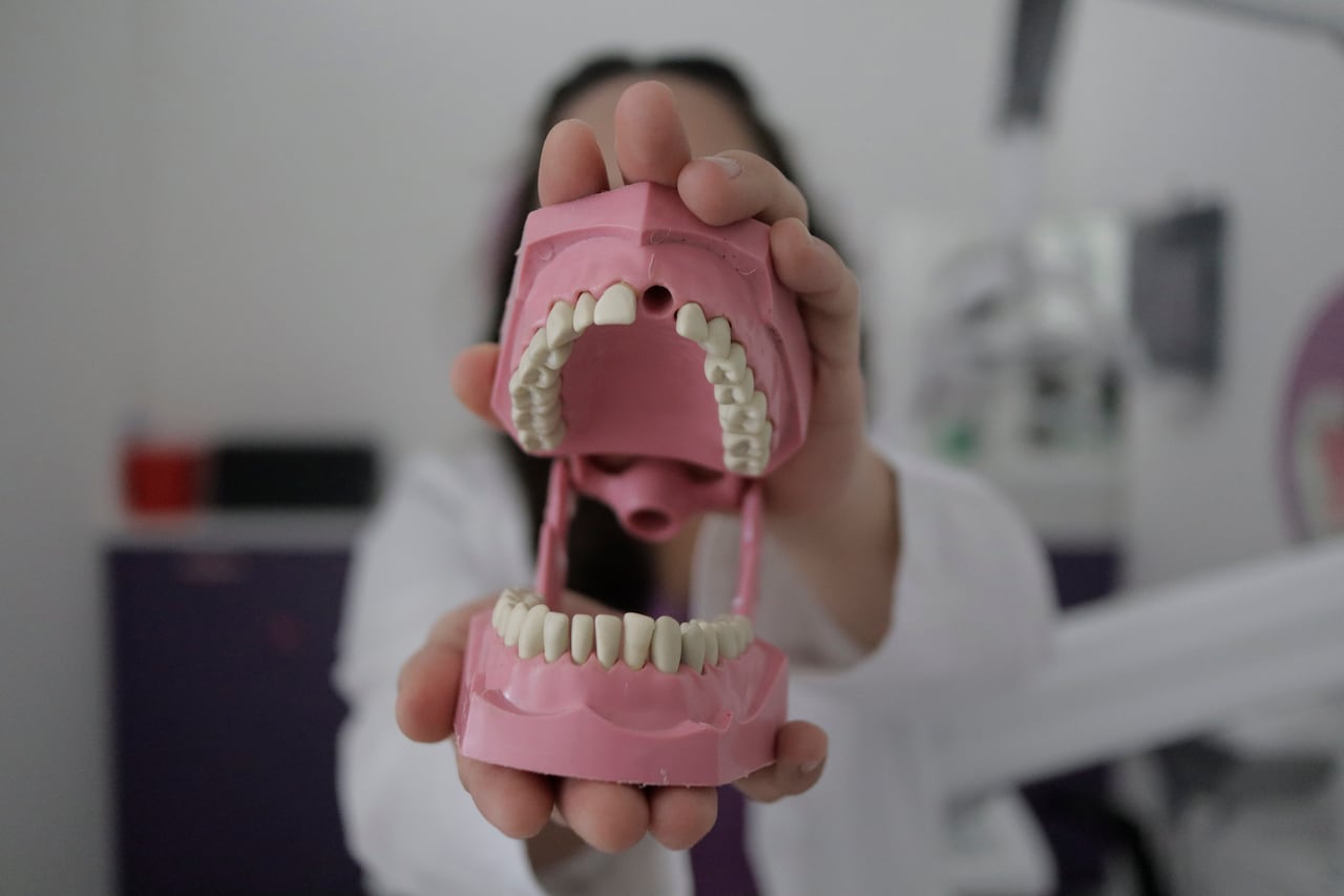 La mordida cruzada debe ser corregida por un especialista