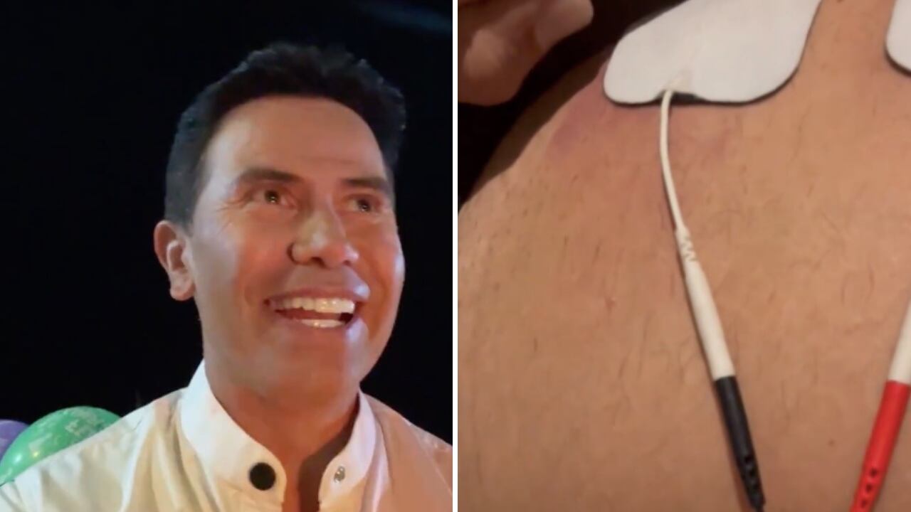 El cantante sufrió un duro golpe y está en terapias para recuperarse