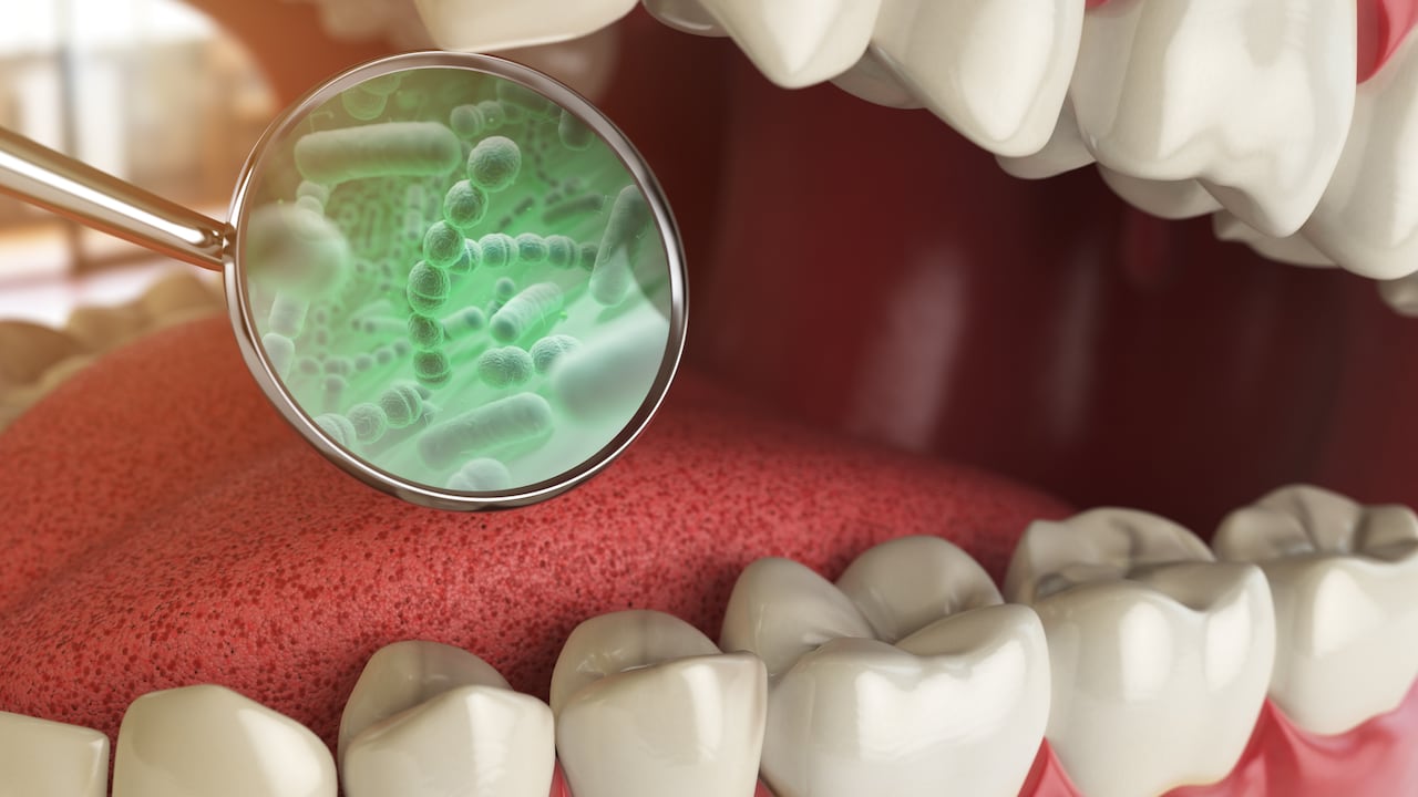 Mal aliento / Bacterias en la boca