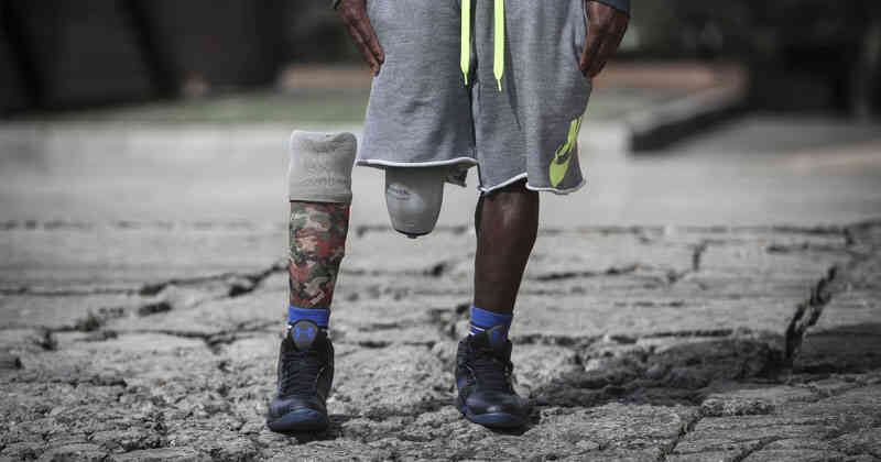 Angie Paola Trespalacios no tiene mayores recuerdos del accidente que la dejó sin su pierna derecha a los 8 años. Hoy es una adolescente extrovertida que quiere ser actriz