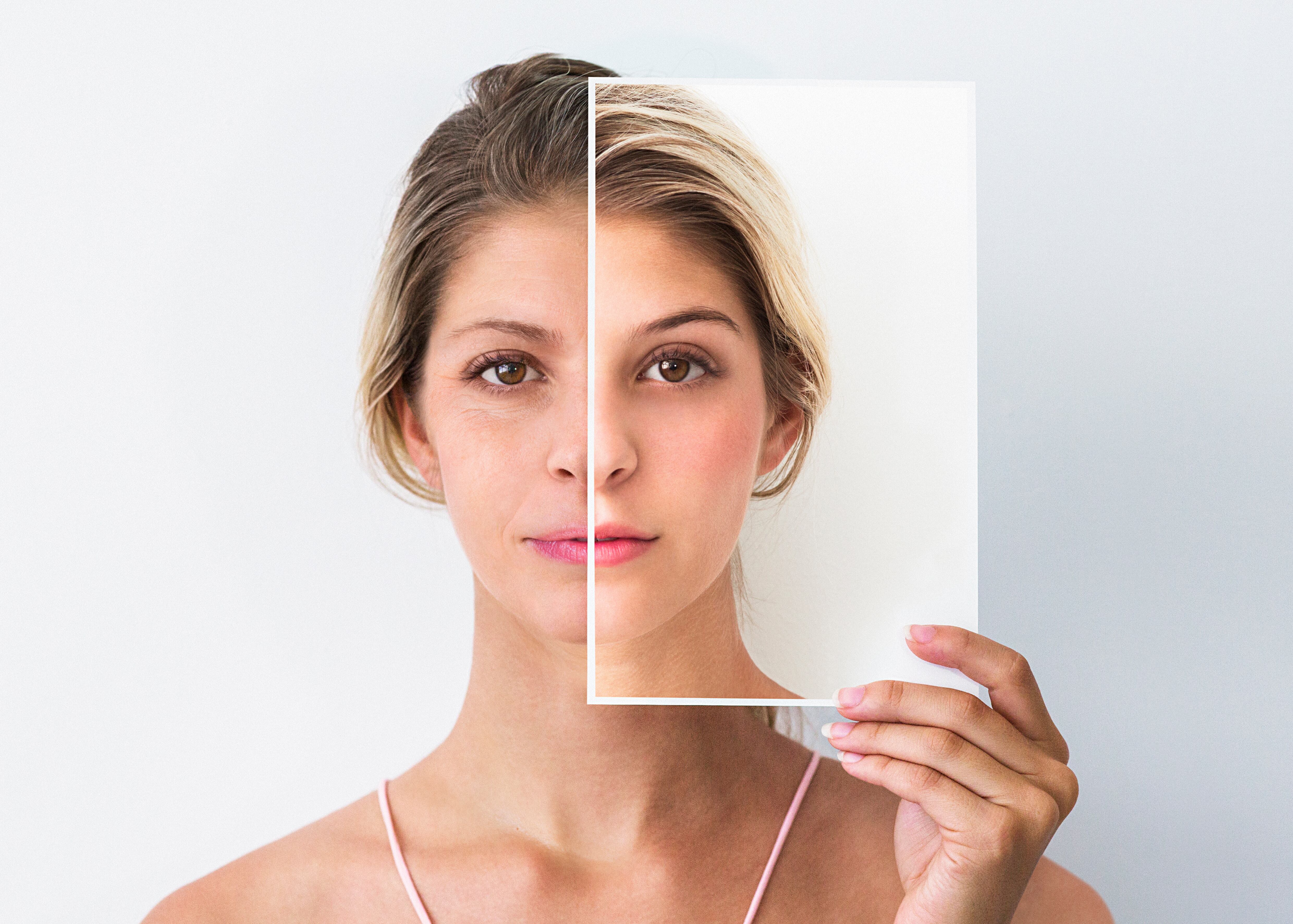 En algunos casos también es recomendable tomar suplementos de colágeno.