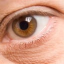 Remedios caseros contra las ojeras, foto: Thinkstock